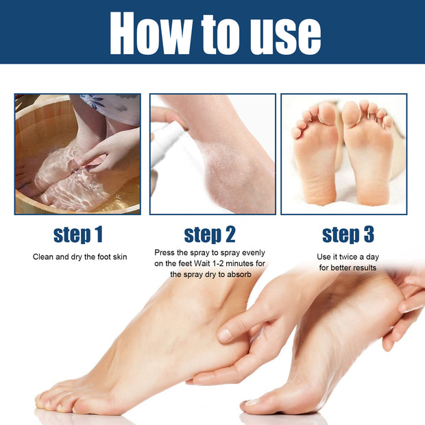 Athletes Foot Relief Spray, Relieve Foot Sweat Foot Itching Peeling Gray Nails Foot Odor Moisturizing Care Spray