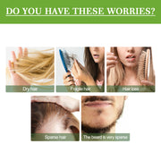 Hair Care Rosemary Oil, Anti-Loss Hair Nourish And Strengthen Hair Care Essential Oil